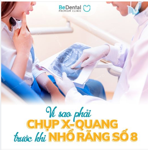 VÌ SAO PHẢI CHỤP X-QUANG TRƯỚC KHI NHỔ RĂNG SỐ 8