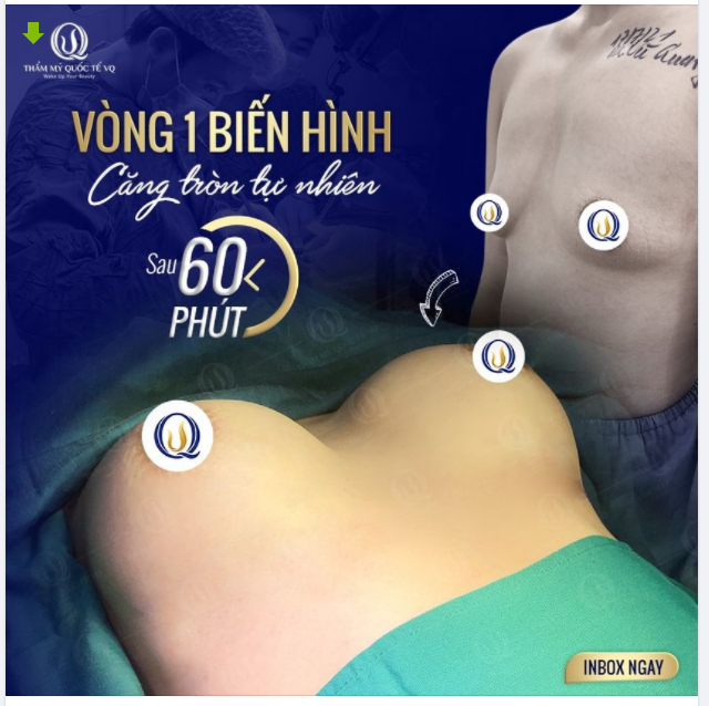 Vòng 1 biến hình - Căng tròn tự nhiên