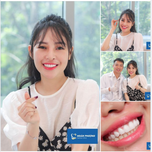 Vừa làm xong là chị bay đi nước ngoài chơi luôn. Không cần kiêng khem gì cả.