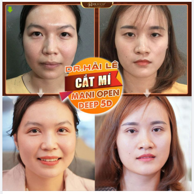 XINH ĐẸP HƠN BỘI PHẦN CHỈ NHỜ MỘT THAY ĐỔI NHỎ Ở ĐÔI MẮT!