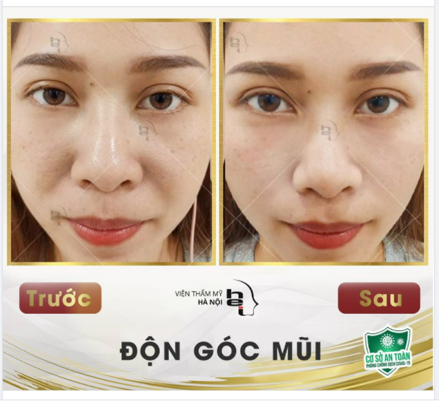 XÓA BỎ "RÂU RỒNG"- HACK TUỔI KHÔNG GIỚI HẠN