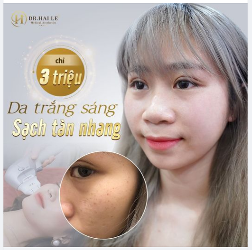 Xóa sạch TÀN NHANG - Da trắng sáng với ưu đãi lớn CHƯA TỪNG CÓ tại Dr.Hải Lê