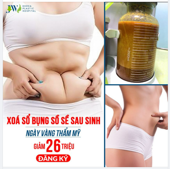 XOÁ SỔ bụng SỒ SỀ, siết vòng eo nhanh chóng