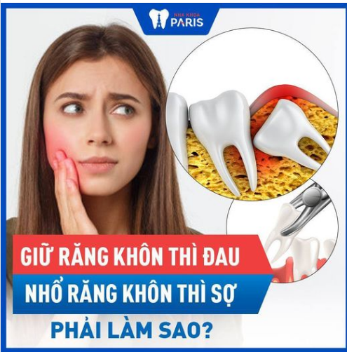 XỬ LÝ RĂNG KHÔN CÔNG NGHỆ 4.0 CÙNG NHA KHOA PARIS