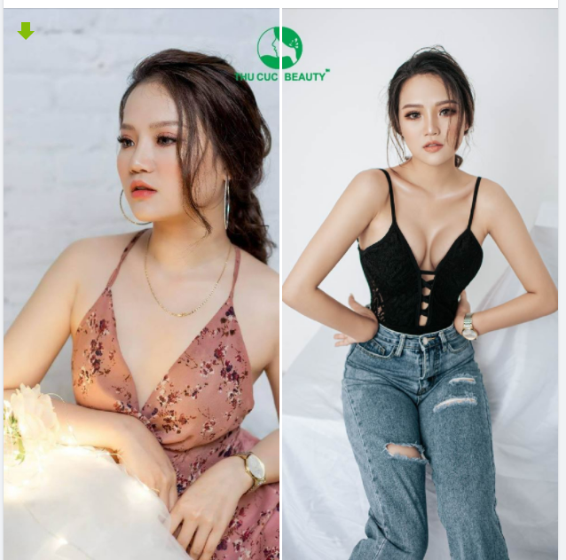 01 LẦN NÂNG V1 - THOÁT LÉP TRỌN ĐỜI