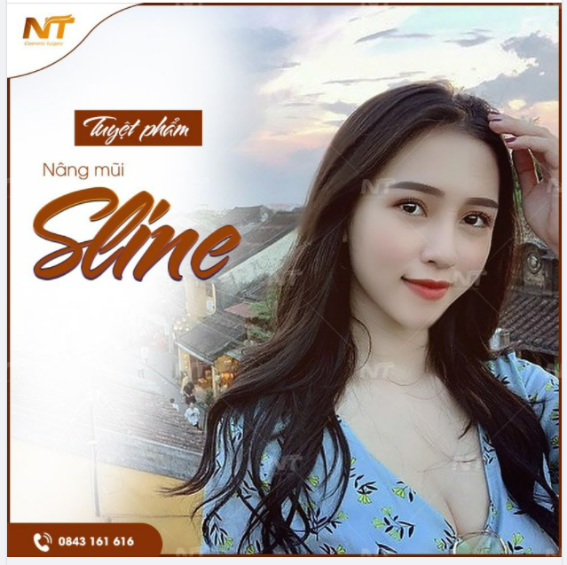 Nâng mũi từ sụn tự thân – Đẹp ngay sau khi nâng chỉ 10tr