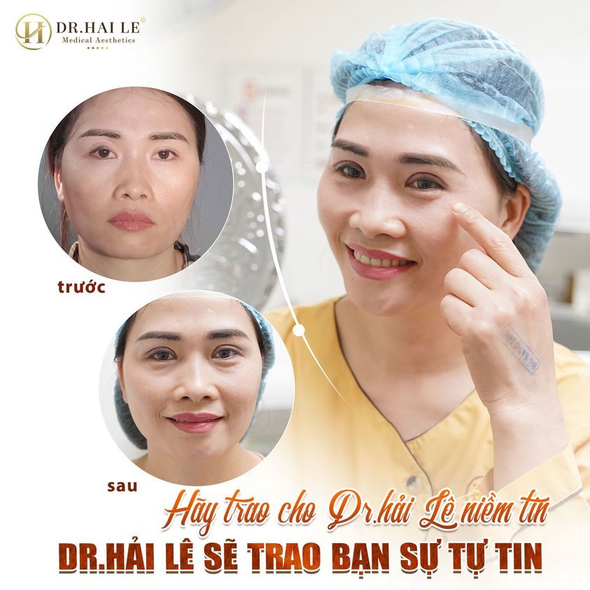 Hơn 1h30p phẫu thuật