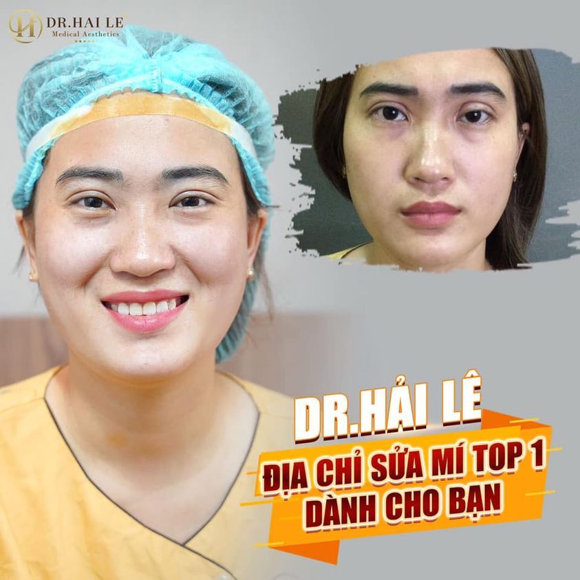 SỬA MÍ DEEP TECH20 - DR.HẢI LÊ TỰ HÀO LÀ ĐỊA CHỈ SỐ 1 SỬA MÍ LỖI, HỎNG.!!