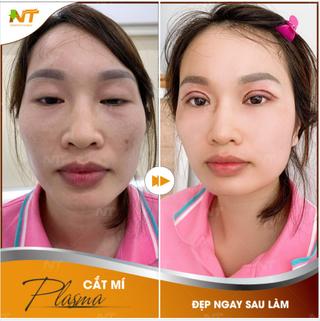 Feedback mí mắt khách hàng ngay sau khi cắt