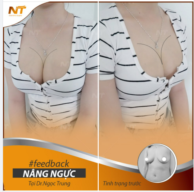 “Tháng của nàng ưu đãi ngập tràn”