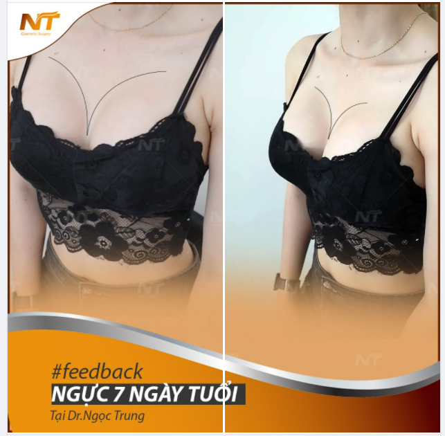 Feedback khách hàng tại DR Ngọc Trung