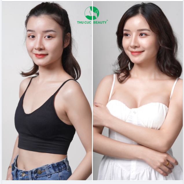 V1 MỚI - DIỆN MẠO MỚI - GIÁ CỰC HỜI