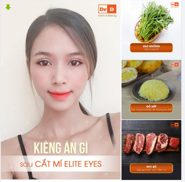 3 loại thực phẩm nên tránh sau phẫu thuật Cắt mí Elite Eyes