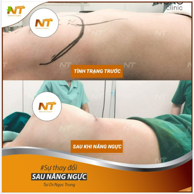 Thay đổi bản thân – tự tin tỏa sáng Feedback ca nâng ngư.c cuối tuần này.