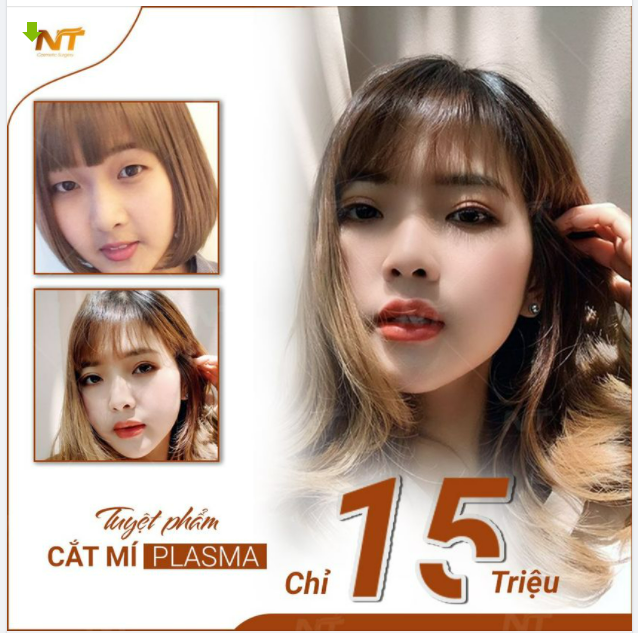 Bạn đã cắt mí plasma nhà DR. Ngọc Trung chưa?