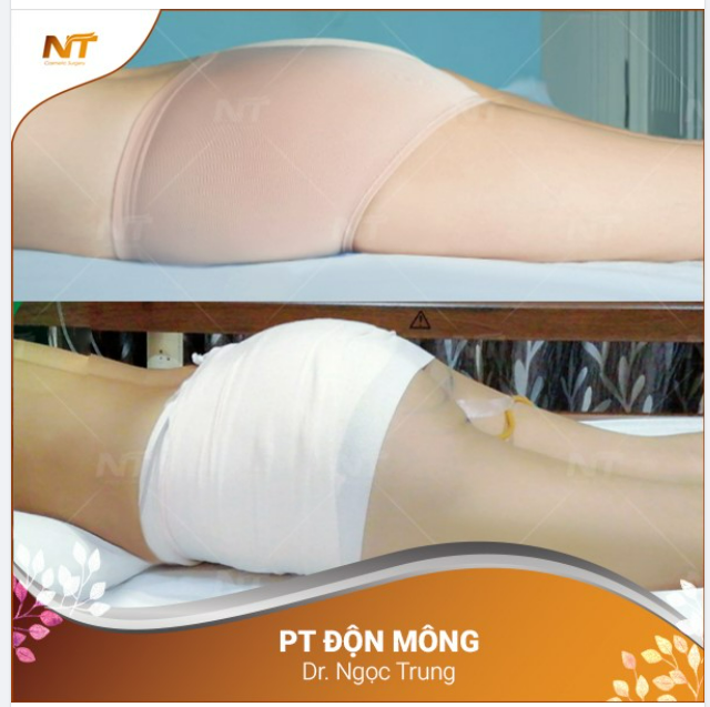 HOT - vòng 3 hoàn hảo cho bà mẹ 2 con