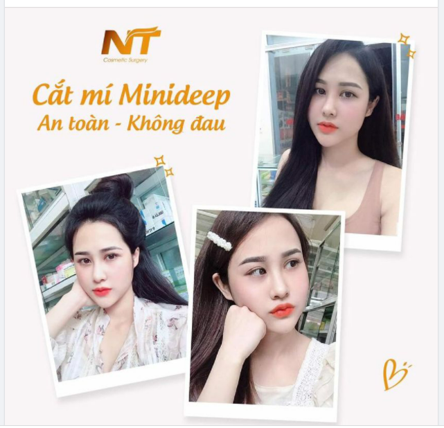 NÂNG TẦM NHAN SẮC CÙNG DR. NGỌC TRUNG CẮT MÍ MINI - ĐẸP NGAY SAU 30'