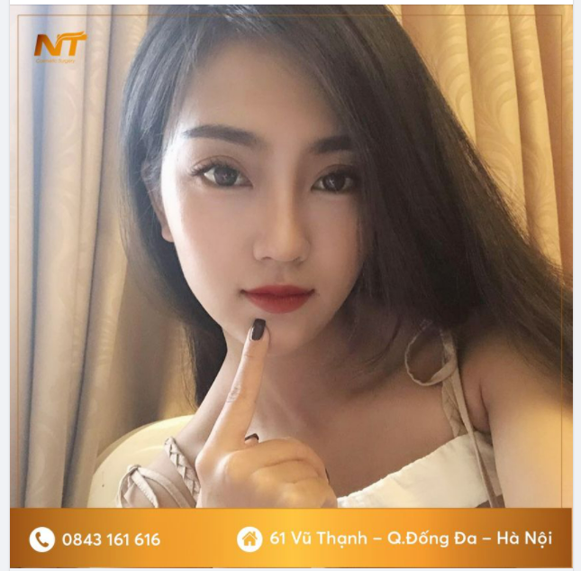 Combo nâng mũi + nhấn mí Dr Ngọc Trung!