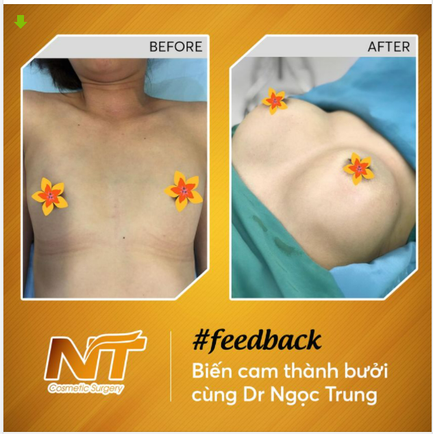 BIẾN CAM THÀNH BƯỞI CHỈ SAU 60' TẠI DR.NGỌC TRUNG