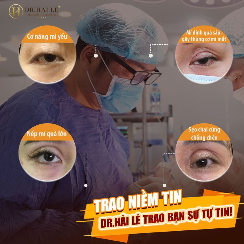 4 TRƯỜNG HỢP THƯỜNG GẶP CỦA MÍ LỖI