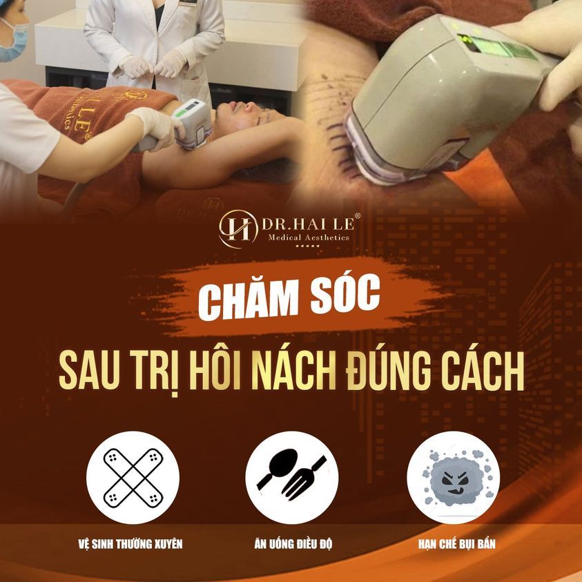 Trị hôi nách Miradry - Cách CHĂM SÓC NHANH BÌNH PHỤC NHẤT