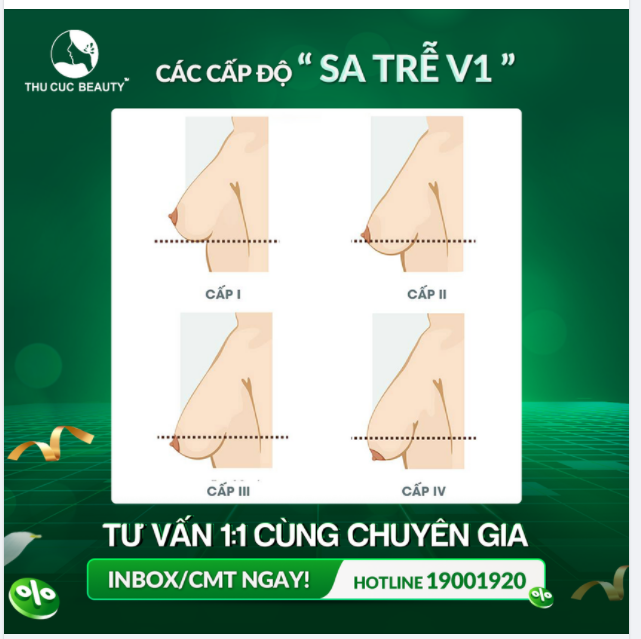 TÌM HIỂU VỀ CÁC CẤP ĐỘ SA TRỄ V1