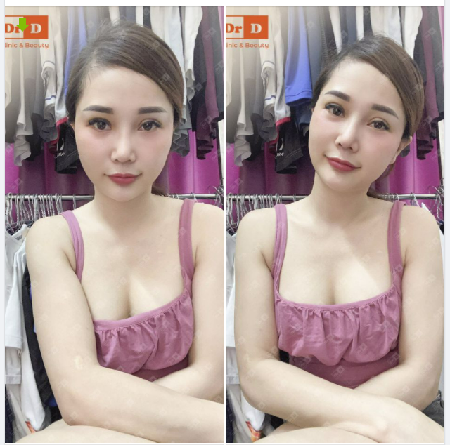 Album tập hợp những hình ảnh khách hàng gửi về cho DrD. Cảm ơn các nàng đã tin tưởng thực hiện và đồng hành cùng DrD
