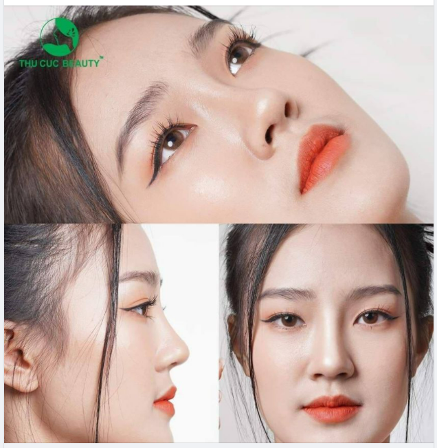 ẤN TƯỢNG KHÓ PHAI ĐẾN TỪ DÁNG MŨI ĐẸP HOÀN HẢO MỌI GÓC ĐỘ