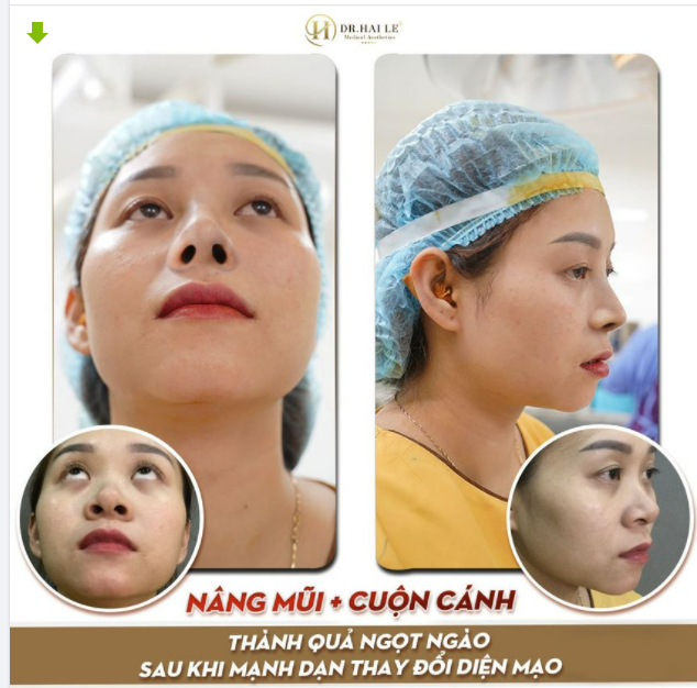 Thành quả ngọt ngào sau khi mạnh dạn thay đổi diện mạo