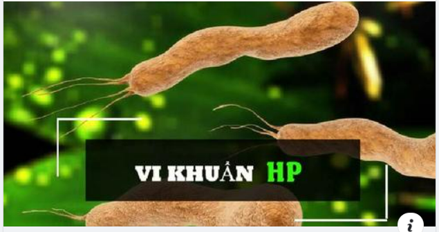 Bị nhiễm vi khuẩn HP có thực hiện được phương pháp Thu nhỏ Dạ dày - Giảm béo?
