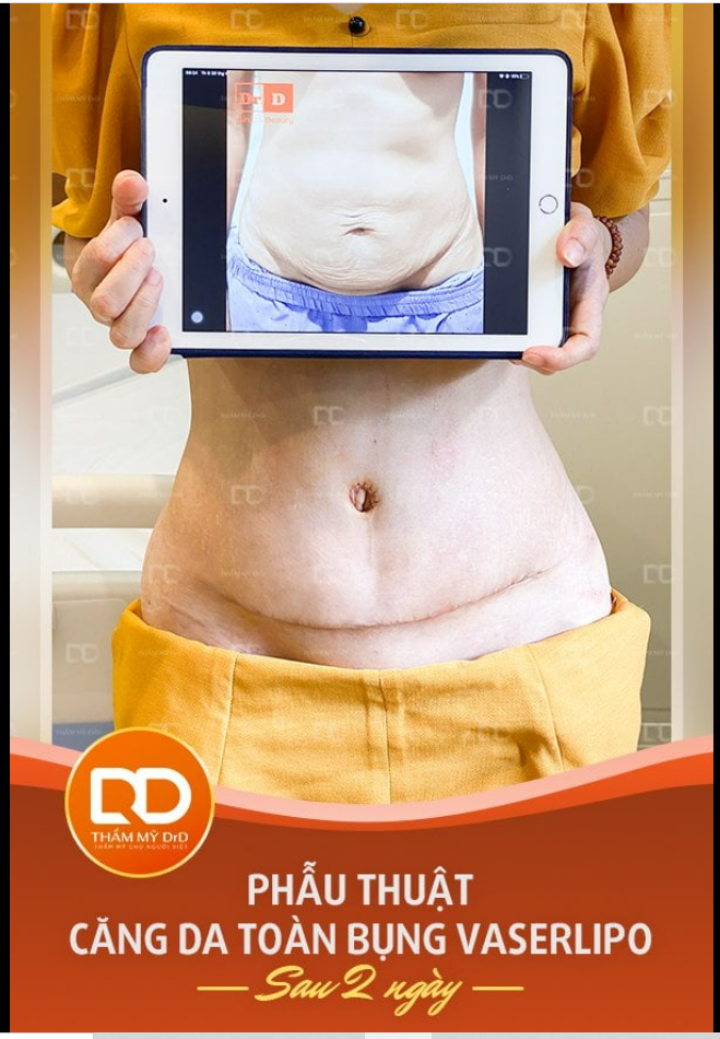 Body "mới toanh" thêm yêu cuộc sống