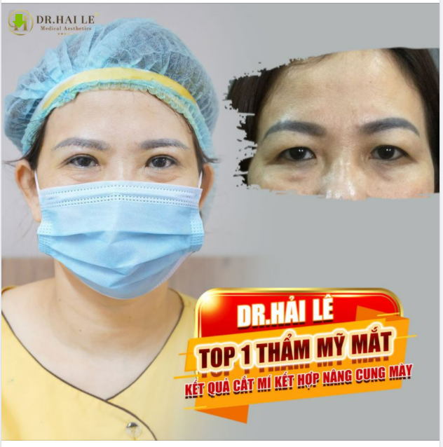 BÍ QUYẾT “CỘNG ĐIỂM” THU HÚT CHO GƯƠNG MẶT