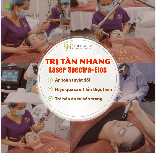 Loại bỏ TÀN NHANG - Lấy lại NHAN SẮC THANH XUÂN chỉ sau 1 buổi điều trị LASER SPECTRA-ELOS