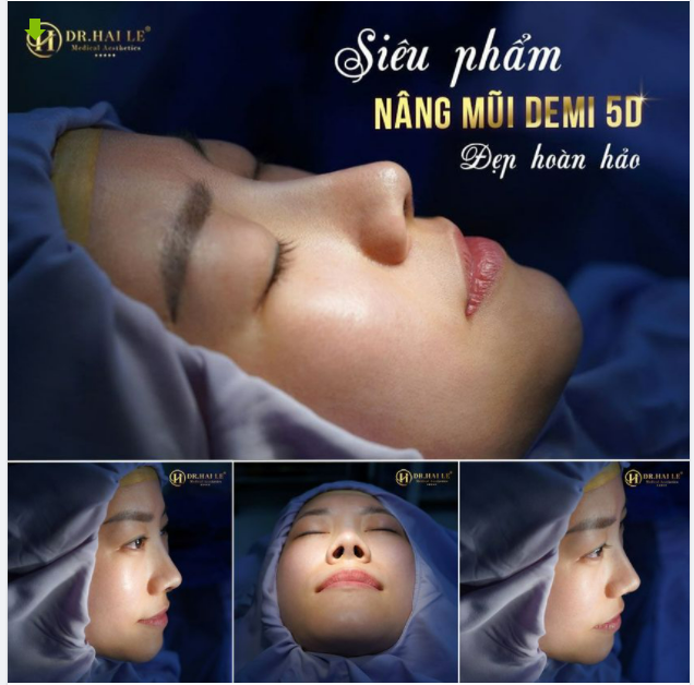 TRƯỜNG HỢP NÀO PHÙ HỢP ĐỂ PHẪU THUẬT NÂNG MŨI