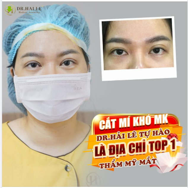 MẮT TRẺ TRUNG, CÓ HỒN HƠN CHỈ SAU 40 PHÚT