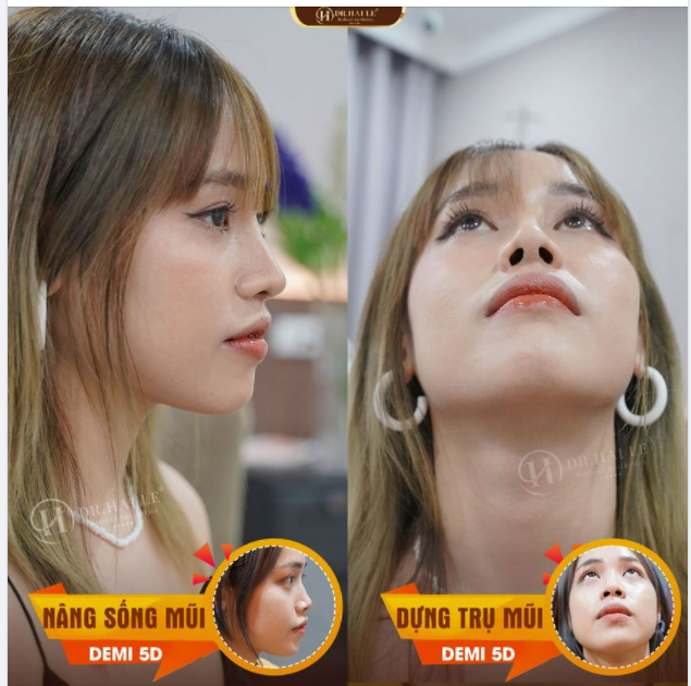 HÃY TRAO DR.HẢI LÊ NIỀM TIN DR.HẢI LÊ SẼ TRAO CHO BẠN SỰ TỰ TIN