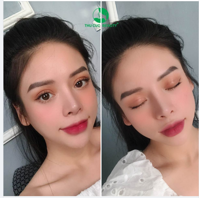 CẮT MÍ CỰC XINH - GIÁ SALE CHẠM ĐỈNH