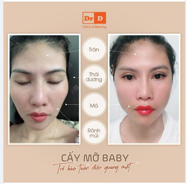 Chắc ai cũng nhận thấy sự khác biệt rõ ràng khi "soi" 2 bức ảnh này nhỉ.