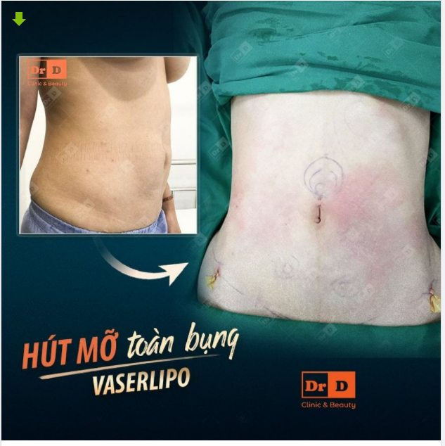 Chẳng phải tự nhiên lại có chuẩn mực: "Nhất dáng nhì da". Vậy nên làm gì thì làm nhưng đừng để bản thân trở nên "nặng nề" hơn nhé.