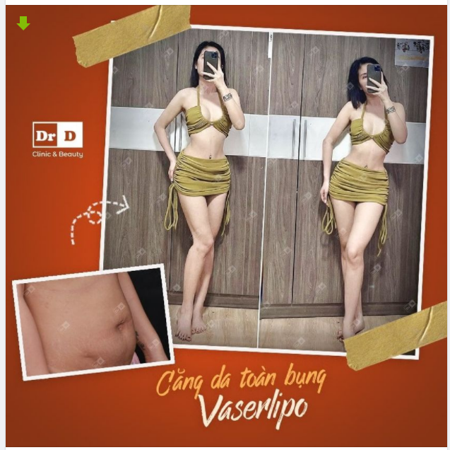 Cho những ai còn đang phân vân chưa thực hiện căng da Vaserlipo