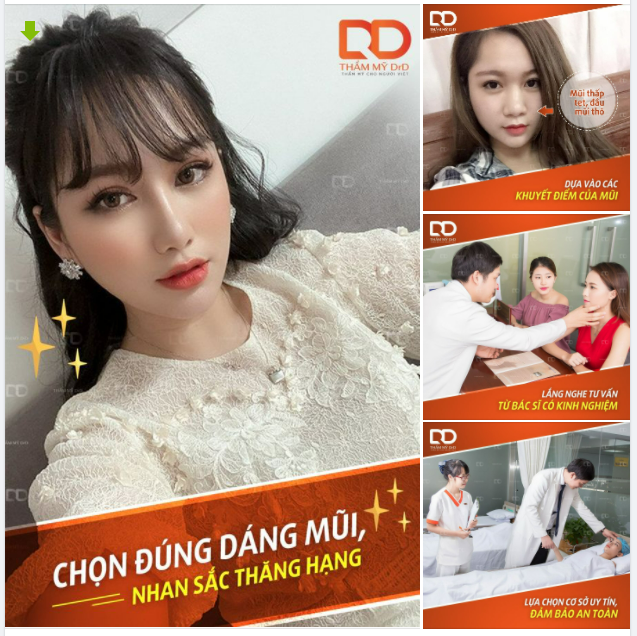 Chọn đúng dáng mũi - Nhan sắc thăng hạng lên vài "chân kính"