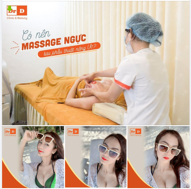 Có nên massage ngực sau phẫu thuật nâng V1 Harmonic?