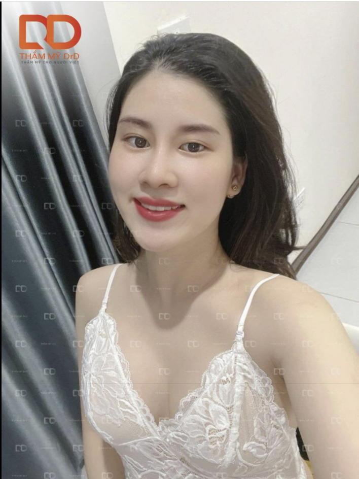 Combo Nâng ngực và Nâng mũi, làm 1 lần 2 dịch vụ không chỉ tiết kiệm thời gian và chi phí mà còn đẹp xinh hoàn hảo luôn nhé các nàng.