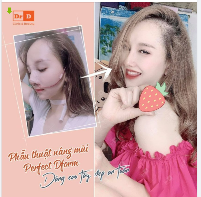 Dáng mũi cao thời thượng, chẳng cần "gắng gượng" vẫn xinh.