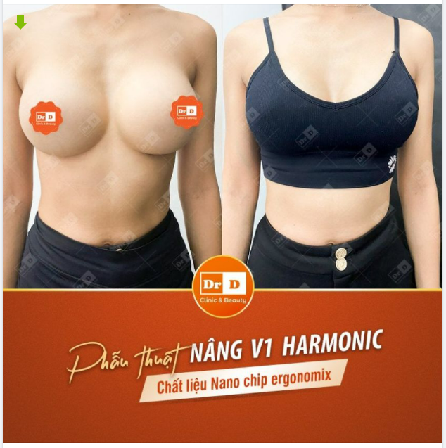 Đố mọi người: Có những dấu hiệu nào để nhận biết ngực "thật" hay ngực "giả"?