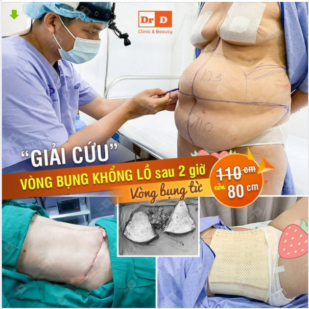 Dù trong ngành đã lâu nhưng mỗi lần hoàn thành xong ca phẫu thuật siêu to khổng lồ là một cảm xúc khác nhau.