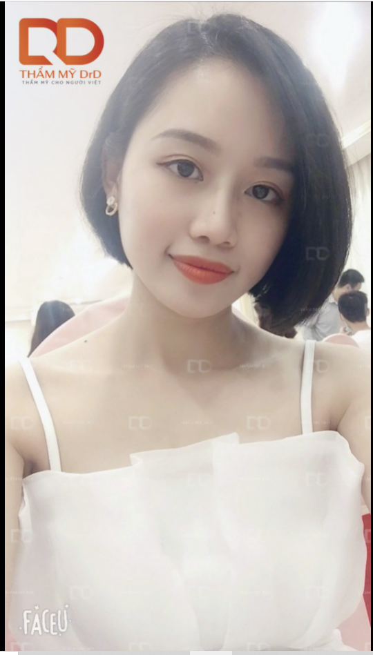 Khoe dáng mũi 2 tháng nào các nàng.