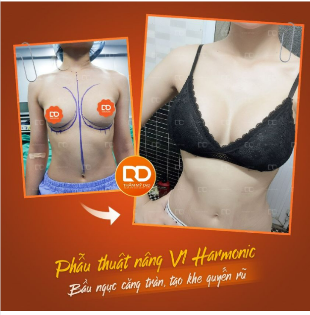 Không cần mặc áo đẩy ngực vẫn tạo khe nóng bỏng, bầu ngực căng tròn.