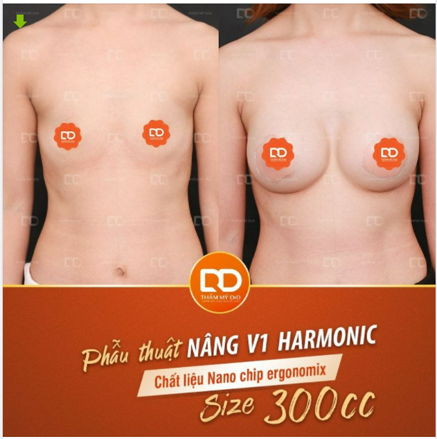 Không thể phủ nhận nhờ các đặc điểm "đặc biệt" của Chất liệu Nano Chip ergonomix sẽ mang lại kết quả V1 không thể hoàn hảo hơn.