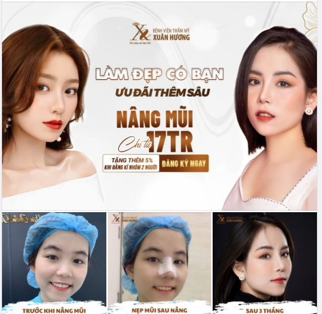 LÀM ĐẸP CÓ ĐÔI - ƯU ĐÃI GẤP BỘI TẠI BVTM XUÂN HƯƠNG